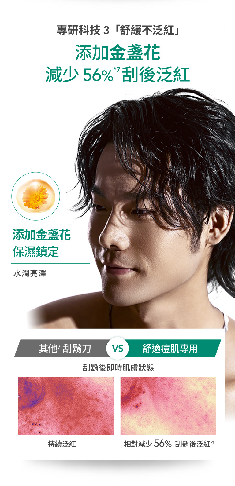 添加金盞花減少56％刮後泛紅