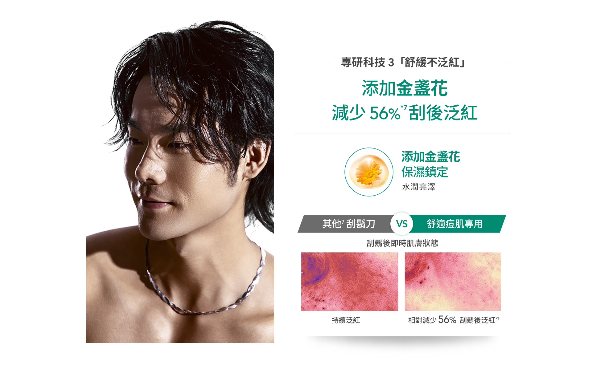 添加金盞花減少56％刮後泛紅